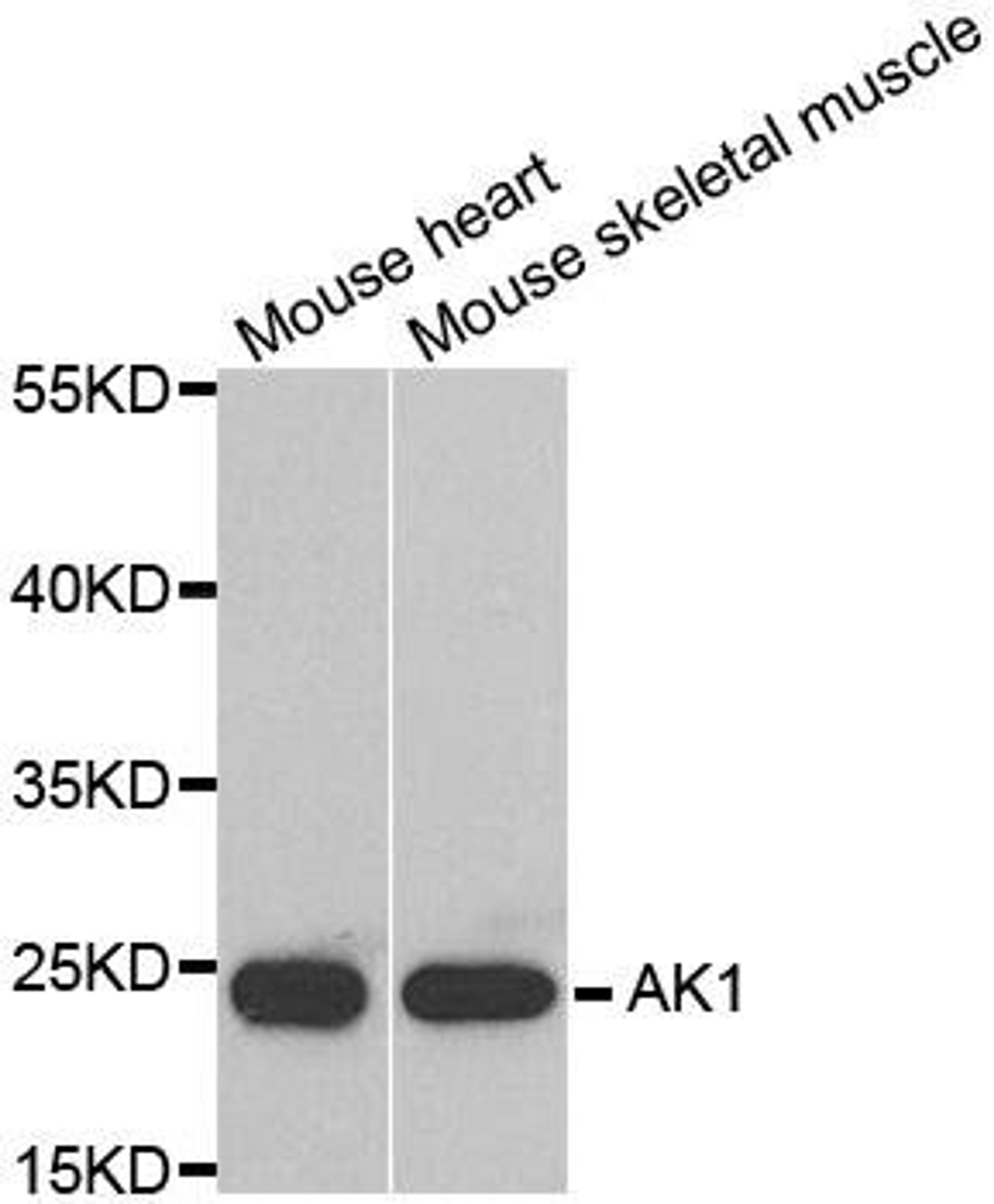 Western blot analysis of extracts of various tissues using AK1 antibody