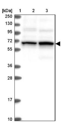 Western Blot: TCHP Antibody [NBP1-89572] - Lane 1: Marker [kDa] 250, 130, 95, 72, 55, 36, 28, 17, 10<br/>Lane 2: Human cell line RT-4<br/>Lane 3: Human cell line U-251MG sp