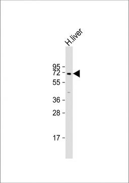 Western Blot at 1:2000 dilution + human liver lysate Lysates/proteins at 20 ug per lane.