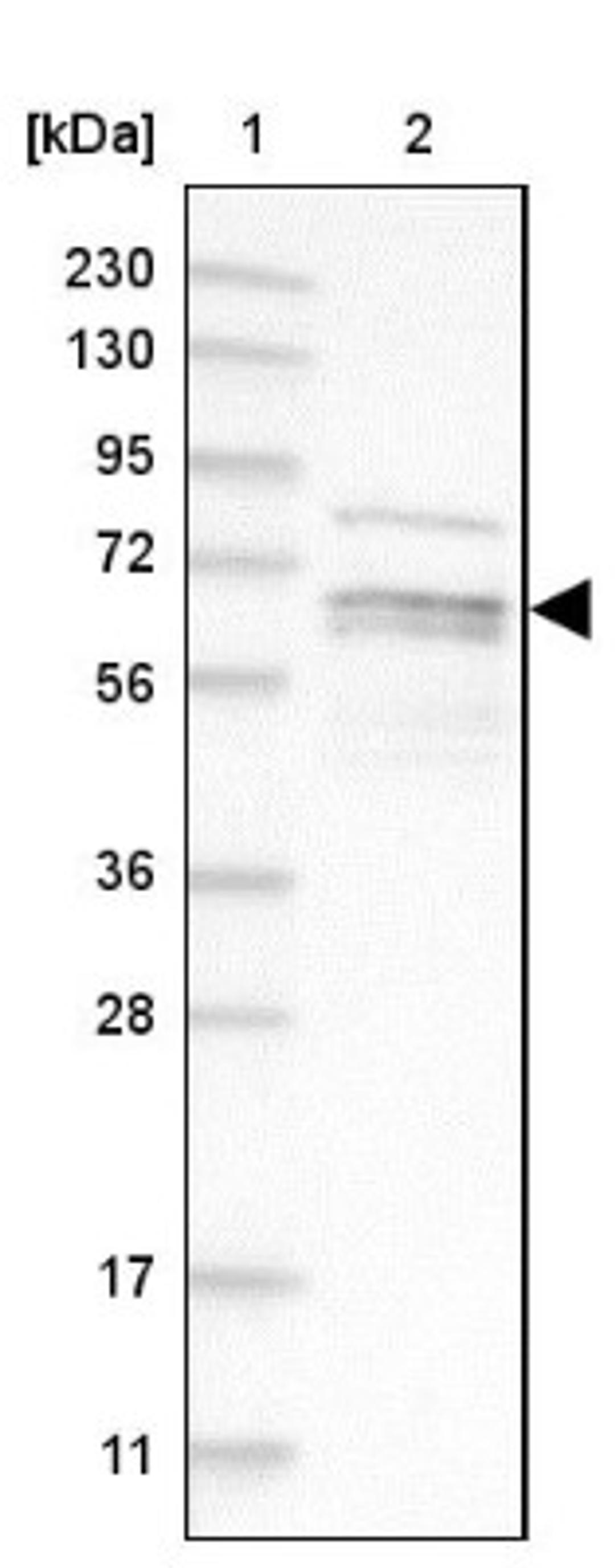 Western Blot: PIP5K1 alpha Antibody [NBP1-90358] - Lane 1: Marker [kDa] 230, 130, 95, 72, 56, 36, 28, 17, 11<br/>Lane 2: Human cell line RT-4