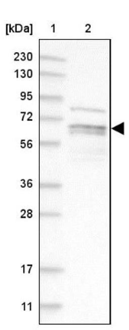 Western Blot: PIP5K1 alpha Antibody [NBP1-90358] - Lane 1: Marker [kDa] 230, 130, 95, 72, 56, 36, 28, 17, 11<br/>Lane 2: Human cell line RT-4