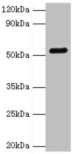Western blot. All lanes: GC antibody at 2ug/ml + Mouse liver tissue. Secondary. Goat polyclonal to rabbit IgG at 1/10000 dilution. Predicted band size: 53, 40, 56 kDa. Observed band size: 53 kDa. 