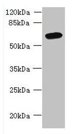 Western blot. All lanes: FAM149B1 antibody at 3µg/ml + Mouse liver tissue. Secondary. Goat polyclonal to rabbit IgG at 1/10000 dilution. Predicted band size: 65, 59 kDa. Observed band size: 65 kDa