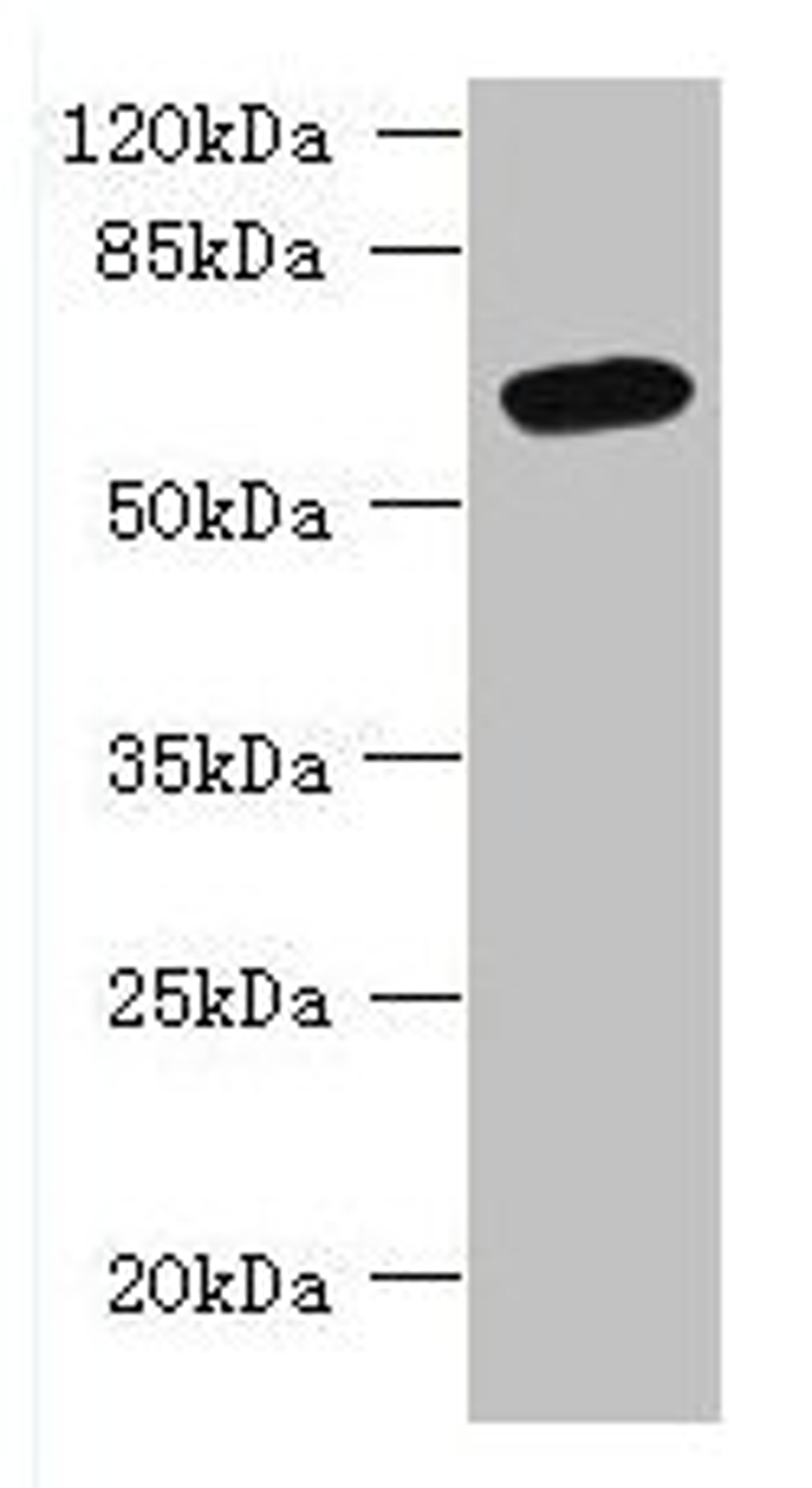 Western blot. All lanes: FAM149B1 antibody at 3µg/ml + Mouse liver tissue. Secondary. Goat polyclonal to rabbit IgG at 1/10000 dilution. Predicted band size: 65, 59 kDa. Observed band size: 65 kDa