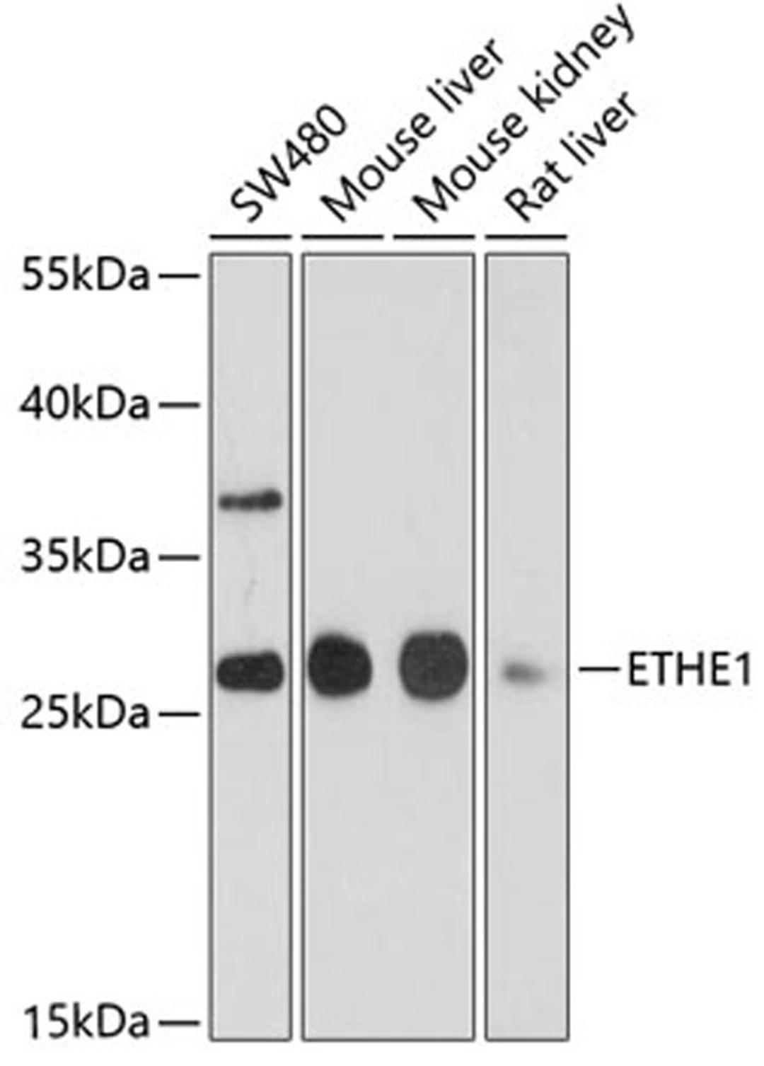 Western blot - ETHE1 antibody (A10142)