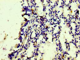 IHC image of CSB-RA801238A0HU diluted at 1:100 and staining in paraffin-embedded human lung tissue performed on a Leica BondTM system. After dewaxing and hydration, antigen retrieval was mediated by high pressure in a citrate buffer (pH 6.0). Section was blocked with 10% normal goat serum 30min at RT. Then primary antibody (1% BSA) was incubated at 4℃ overnight. The primary is detected by a biotinylated secondary antibody and visualized using an HRP conjugated SP system.