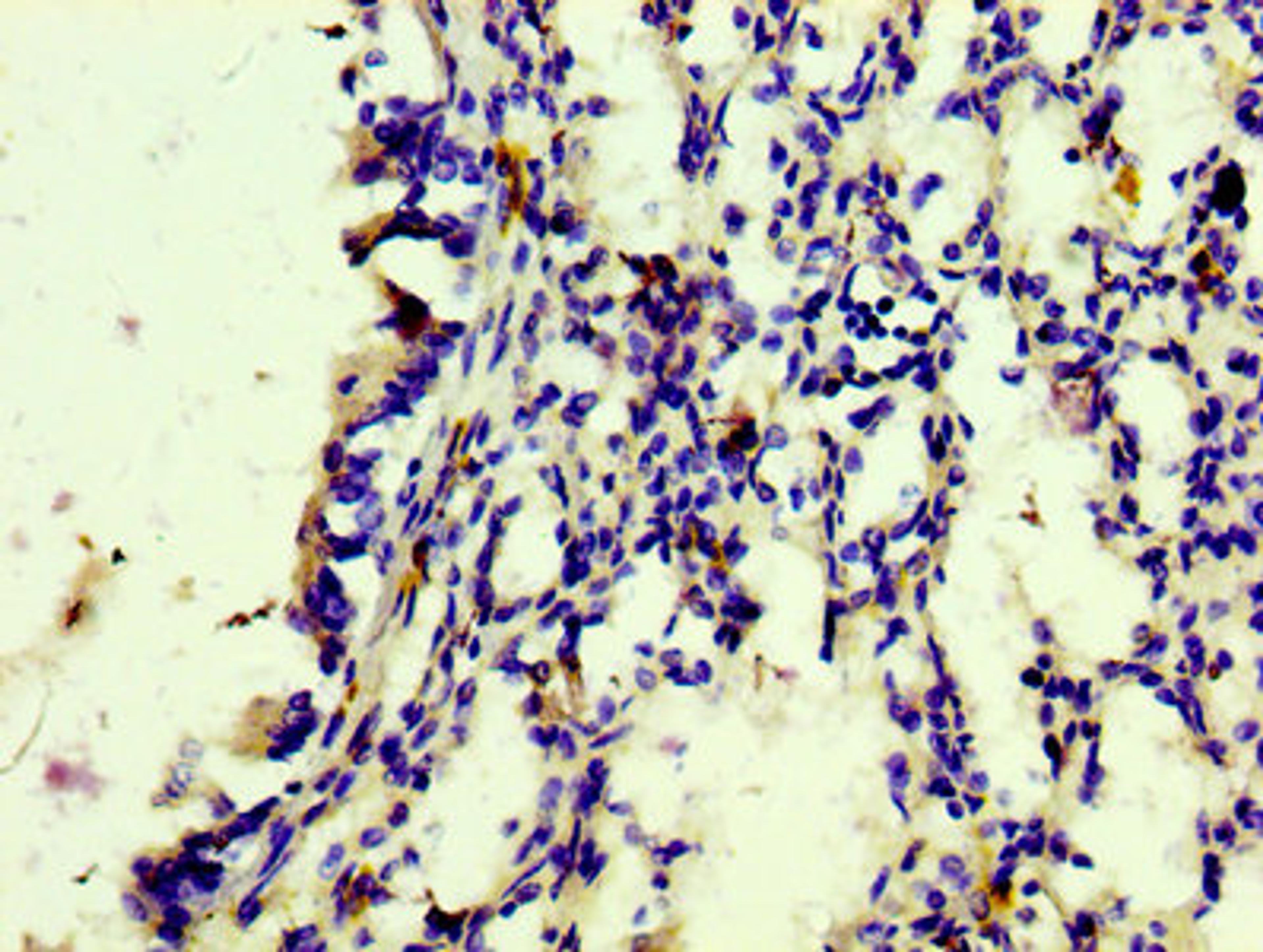 IHC image of CSB-RA801238A0HU diluted at 1:100 and staining in paraffin-embedded human lung tissue performed on a Leica BondTM system. After dewaxing and hydration, antigen retrieval was mediated by high pressure in a citrate buffer (pH 6.0). Section was blocked with 10% normal goat serum 30min at RT. Then primary antibody (1% BSA) was incubated at 4℃ overnight. The primary is detected by a biotinylated secondary antibody and visualized using an HRP conjugated SP system.
