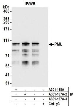 Detection of human PML by western blot of immunoprecipitates.