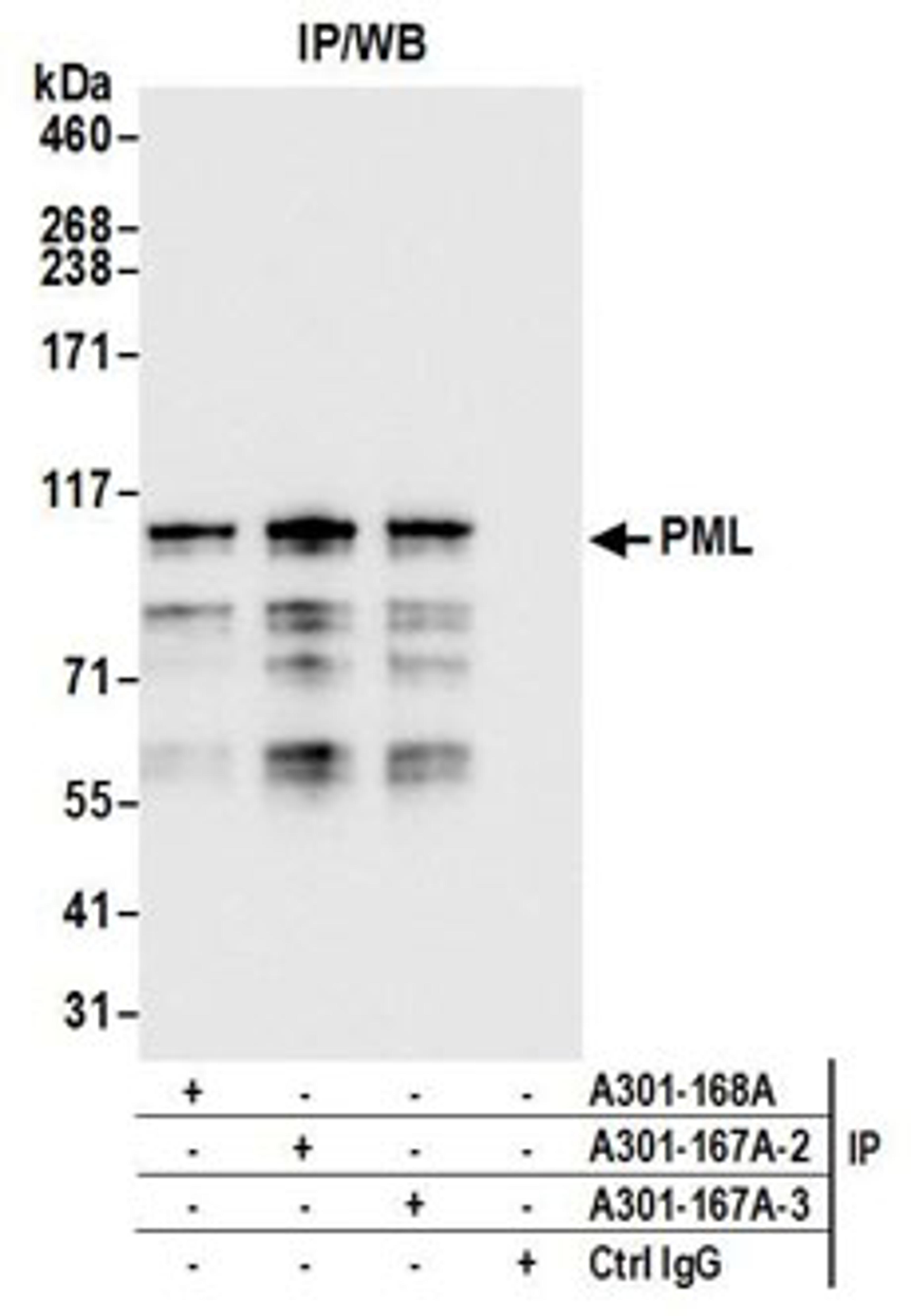 Detection of human PML by western blot of immunoprecipitates.