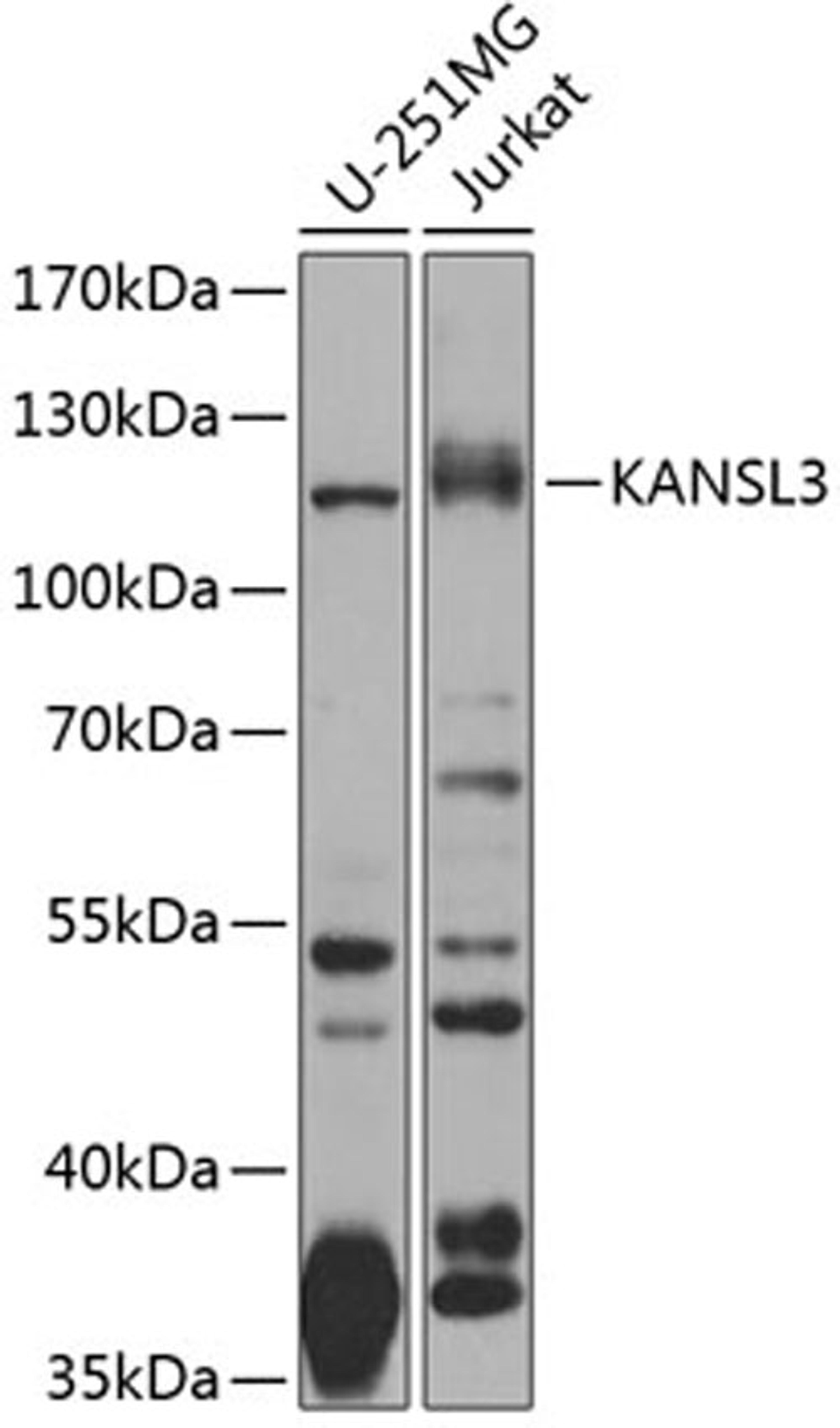 Western blot - KANSL3 antibody (A8234)