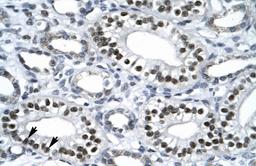 Antibody used in IHC on Human kidney.