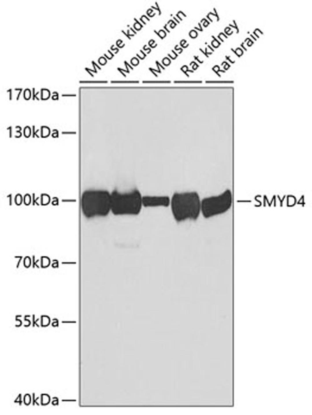 Western blot - SMYD4 antibody (A7310)