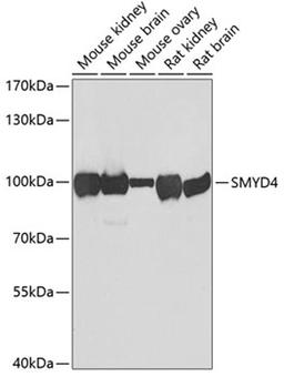 Western blot - SMYD4 antibody (A7310)