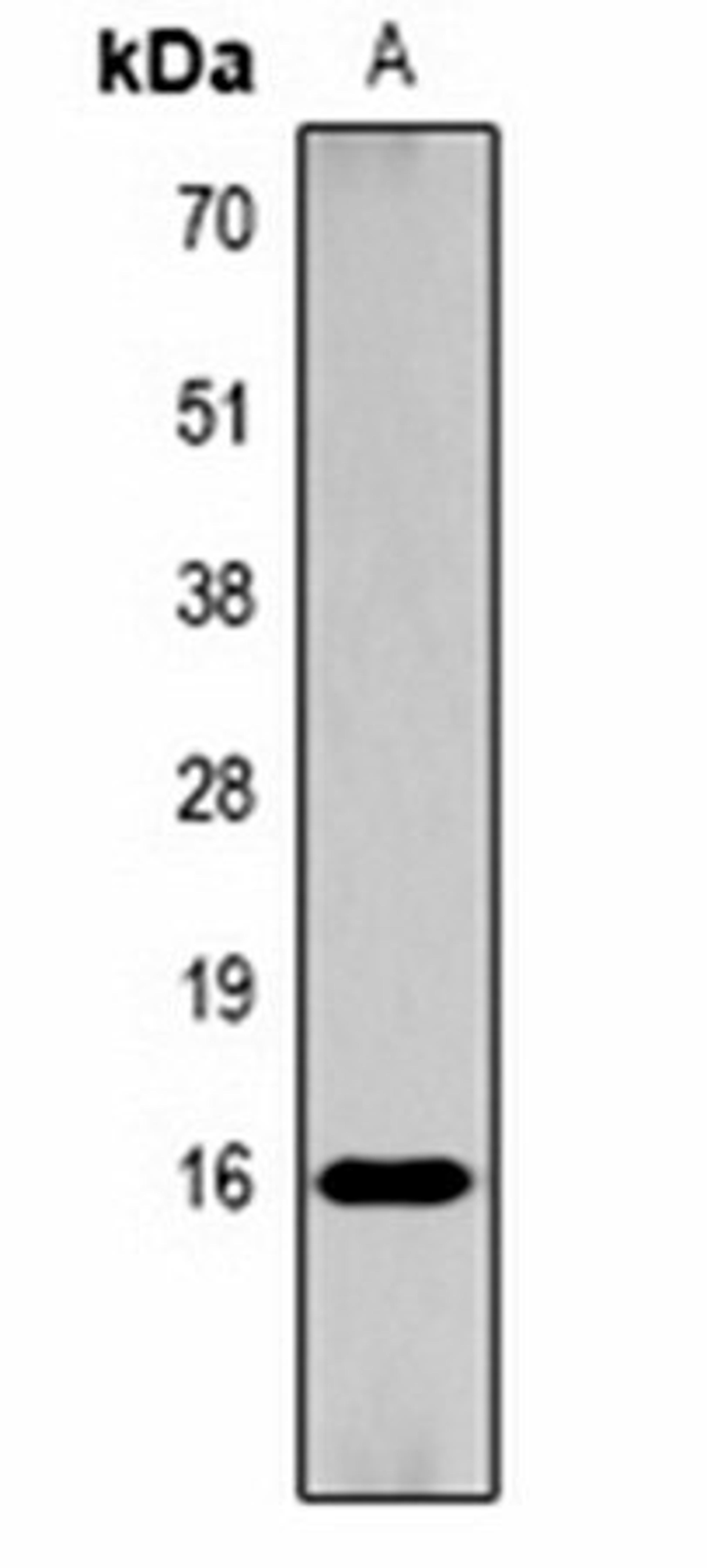 Western blot analysis of  Hela TSA-treated (Lane1) whole cell lysates using Histone H3 (AcK9) antibody