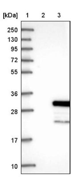 Western Blot: RERG Antibody [NBP1-82746] - Lane 1: Marker [kDa] 250, 130, 95, 72, 55, 36, 28, 17, 10<br/>Lane 2: Negative control (vector only transfected HEK293T lysate)<br/>Lane 3: Over-expression lysate (Co-expressed with a C-terminal myc-DDK tag (~3.1 kDa) in mammalian HEK293T cells, LY409869)