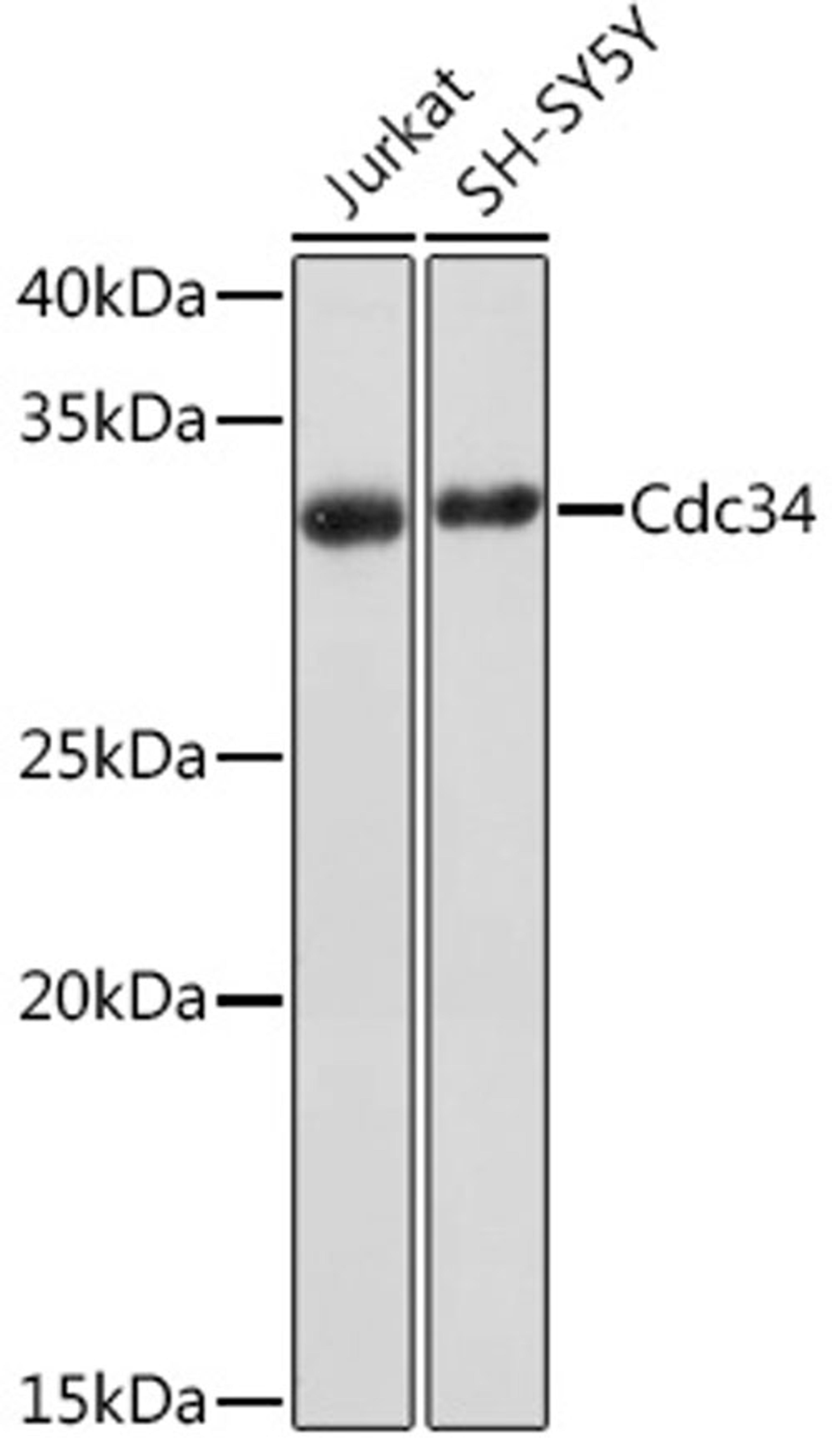 Western blot - Cdc34 Rabbit mAb (A9772)