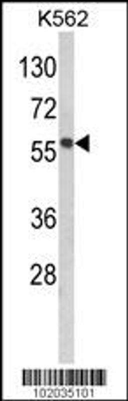 Western blot analysis of hMMP19-R359 in K562 cell line lysates (35ug/lane)