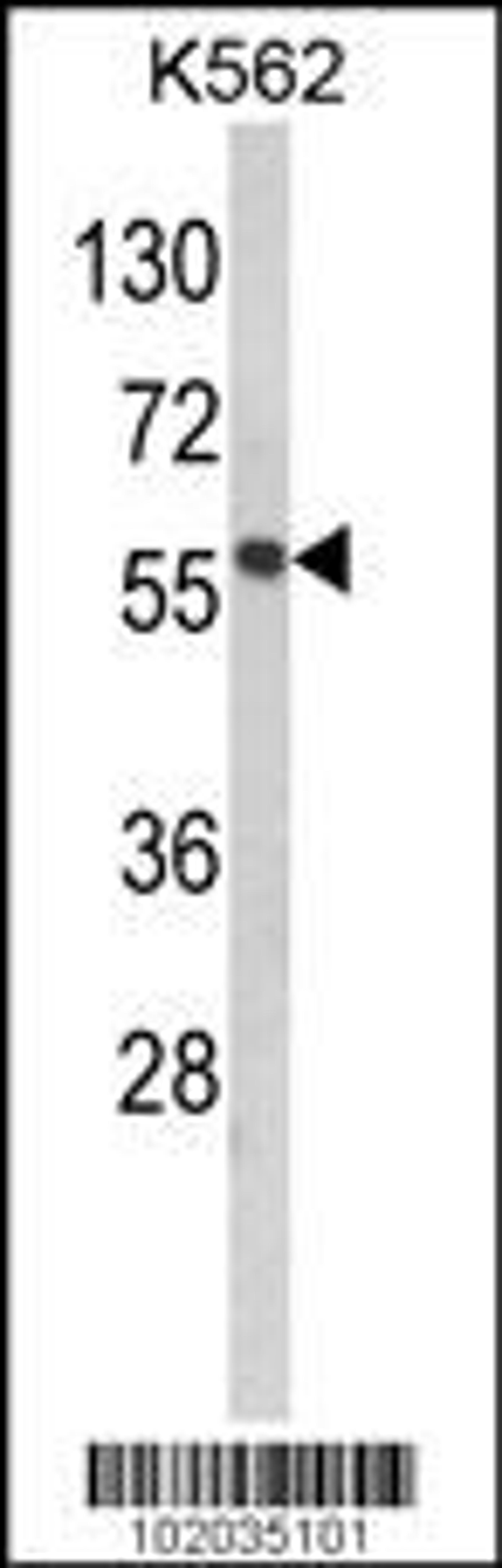 Western blot analysis of hMMP19-R359 in K562 cell line lysates (35ug/lane)