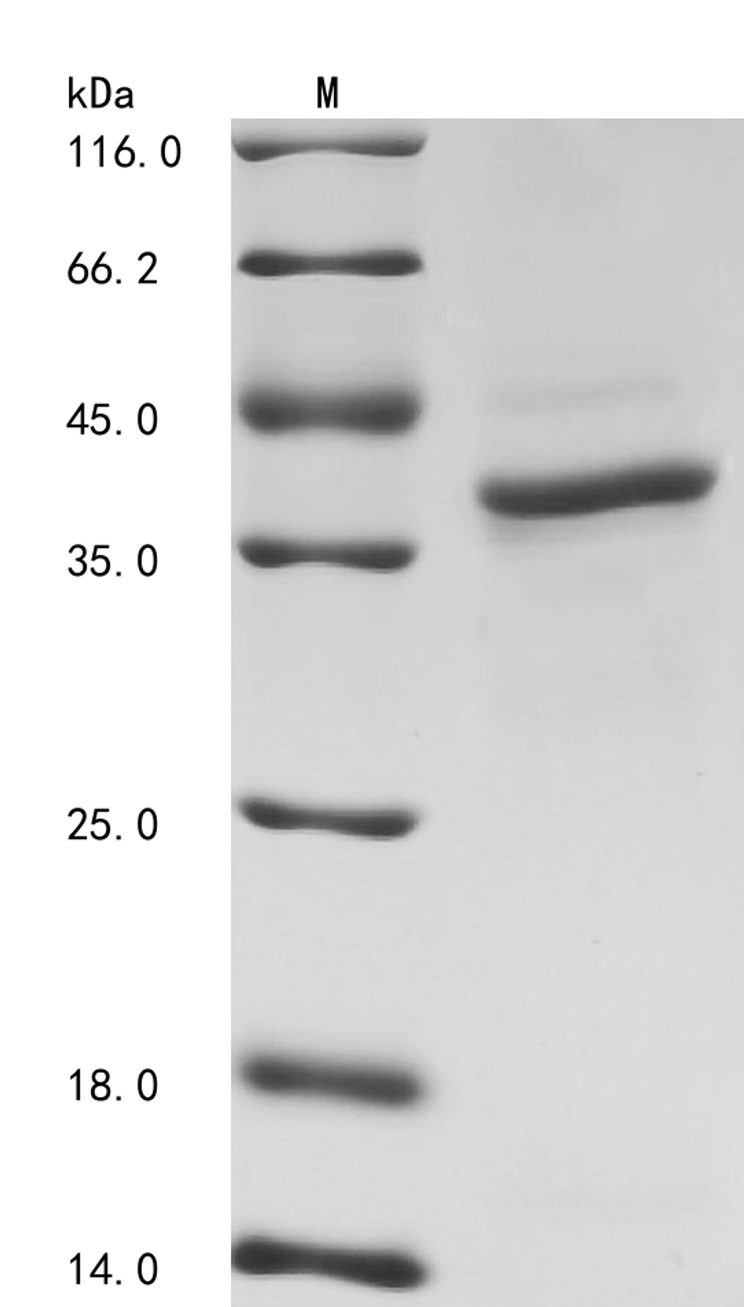 (Tris-Glycine gel) Discontinuous SDS-PAGE (reduced) with 5% enrichment gel and 15% separation gel.