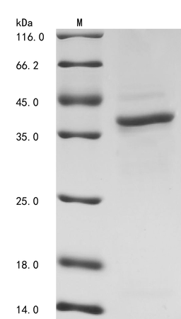 (Tris-Glycine gel) Discontinuous SDS-PAGE (reduced) with 5% enrichment gel and 15% separation gel.
