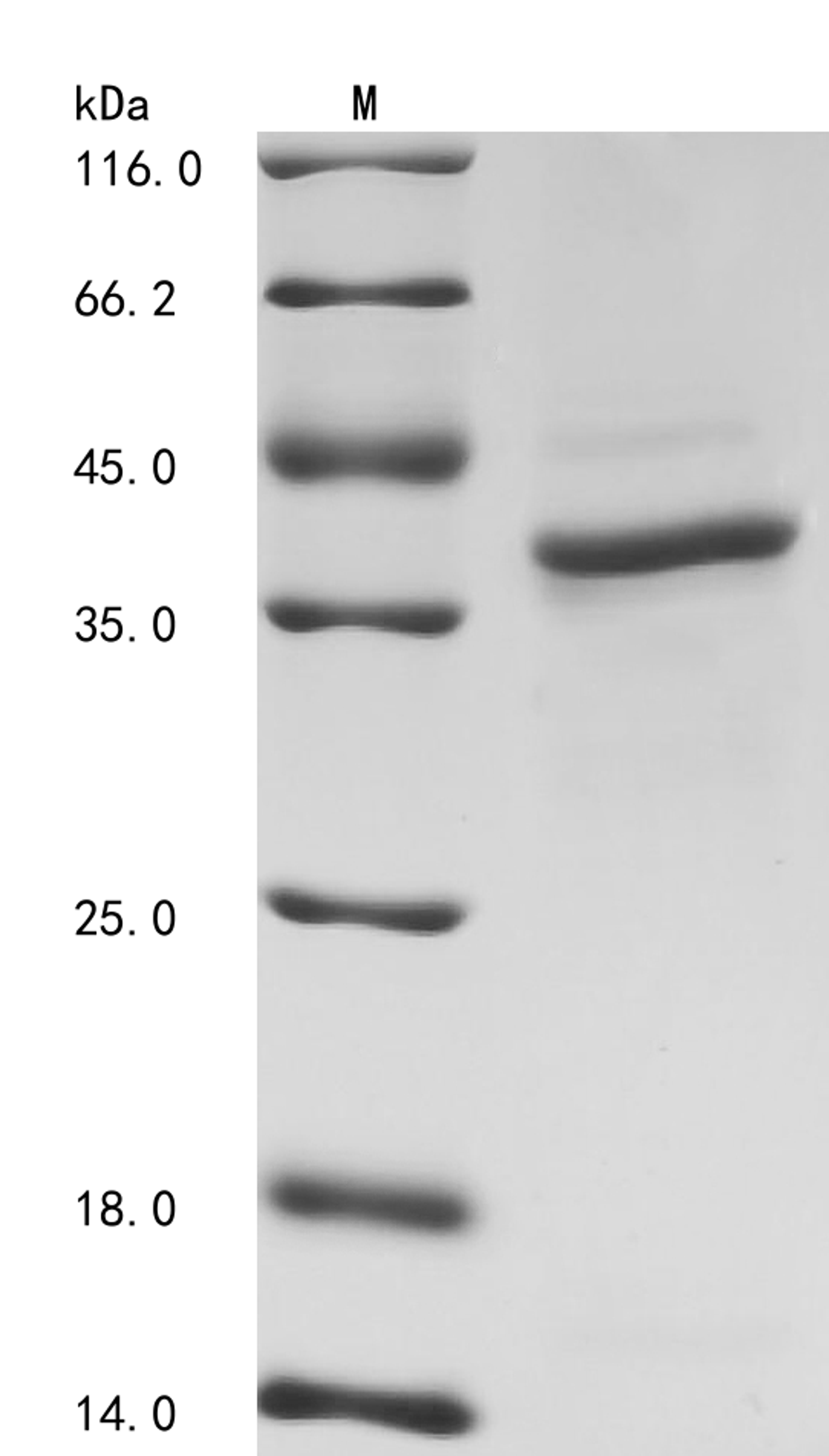 (Tris-Glycine gel) Discontinuous SDS-PAGE (reduced) with 5% enrichment gel and 15% separation gel.