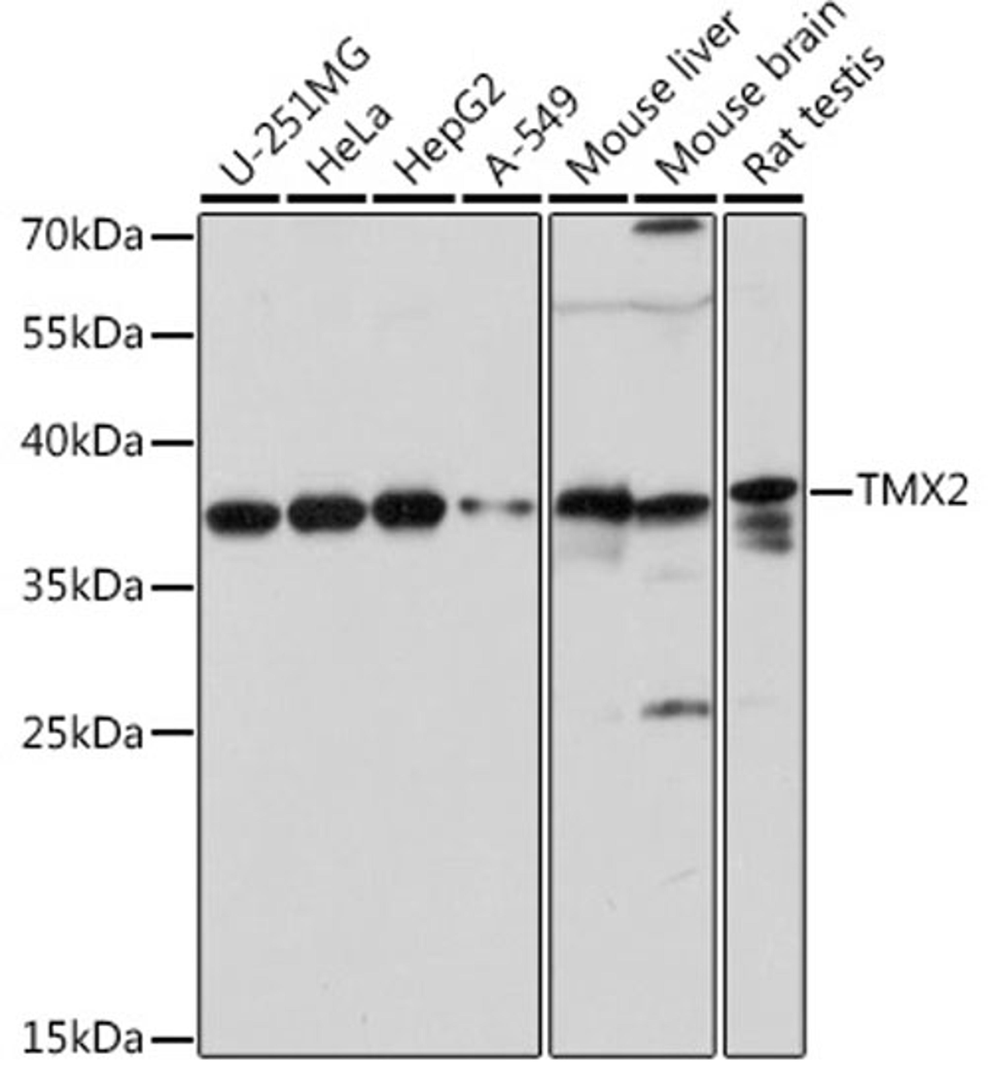 Western blot - TMX2 pAb (A17148)