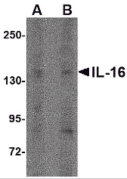 Western blot analysis of IL-16 in rat brain tissue lysate with IL-16 antibody at (A) 1 &#956;g/ml and (B) 2 &#956;g/mL.