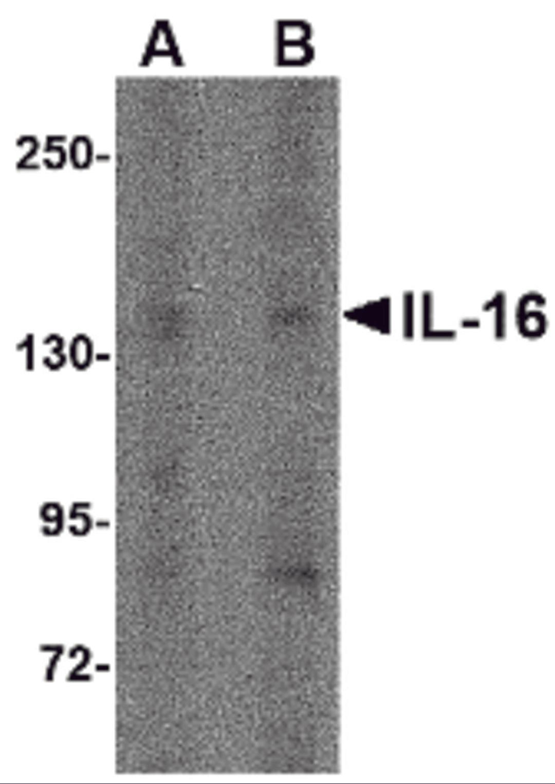 Western blot analysis of IL-16 in rat brain tissue lysate with IL-16 antibody at (A) 1 μg/ml and (B) 2 μg/mL.