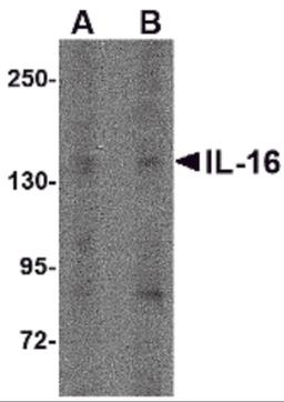 Western blot analysis of IL-16 in rat brain tissue lysate with IL-16 antibody at (A) 1 μg/ml and (B) 2 μg/mL.