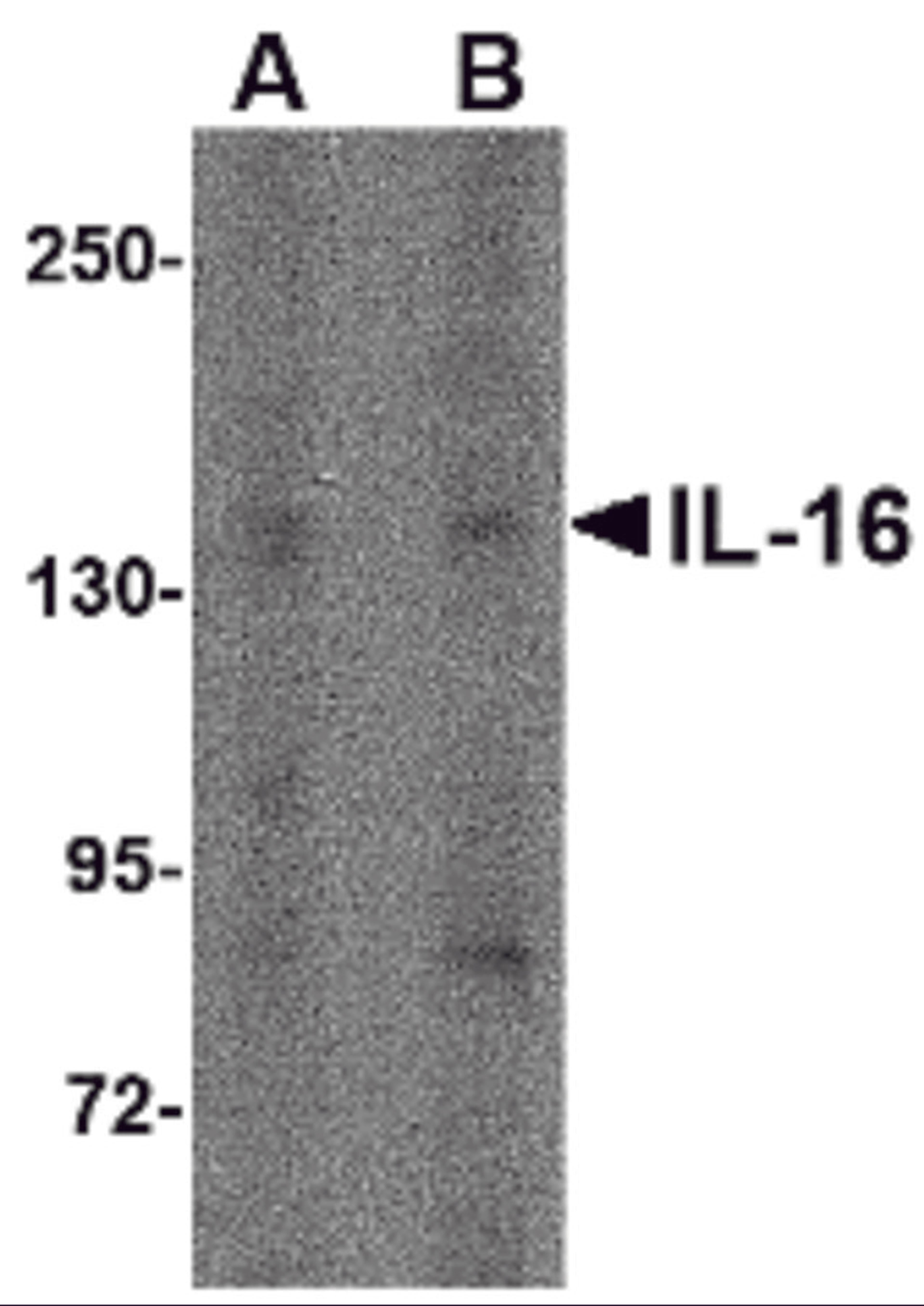 Western blot analysis of IL-16 in rat brain tissue lysate with IL-16 antibody at (A) 1 μg/ml and (B) 2 μg/mL.