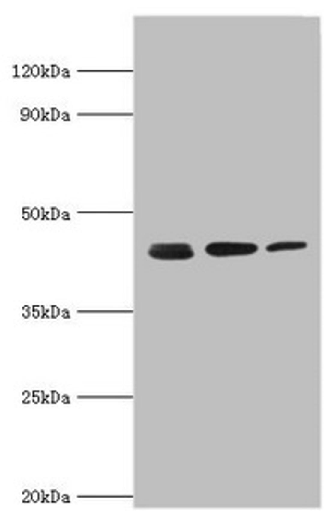 Western blot. All lanes: Actin-related protein 2 antibody at 3ug/ml. Lane 1: Mouse spleen tissue. Lane 2: Jurkat whole cell lysate. Lane 3: MCF-7 whole cell lysate. Secondary. Goat polyclonal to rabbit IgG at 1/10000 dilution. Predicted band size: 45, 46 kDa. Observed band size: 45 kDa.