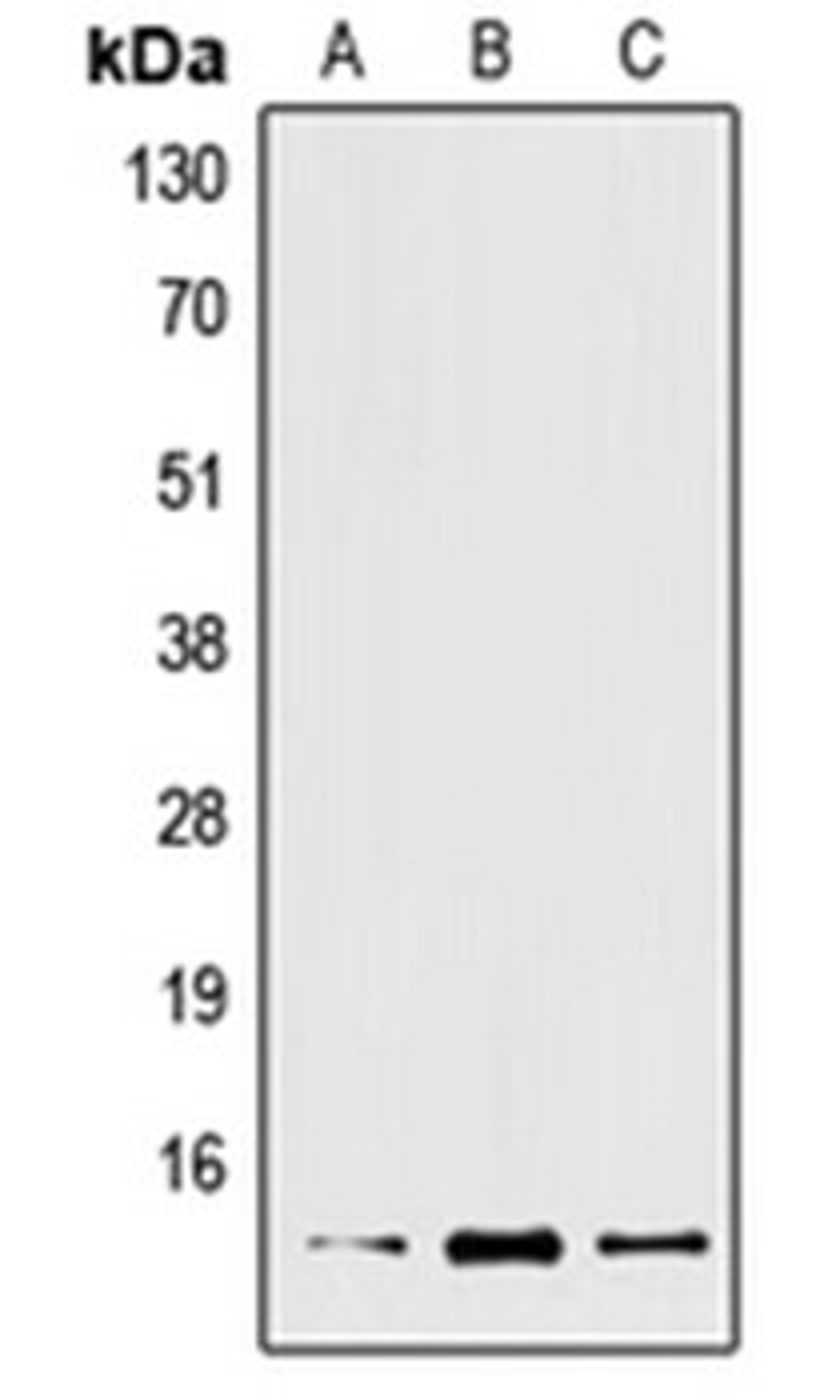 Western blot analysis of Jurkat (Lane 1), mouse liver (Lane 2), rat liver (Lane 3) whole cell lysates using XCL2 antibody