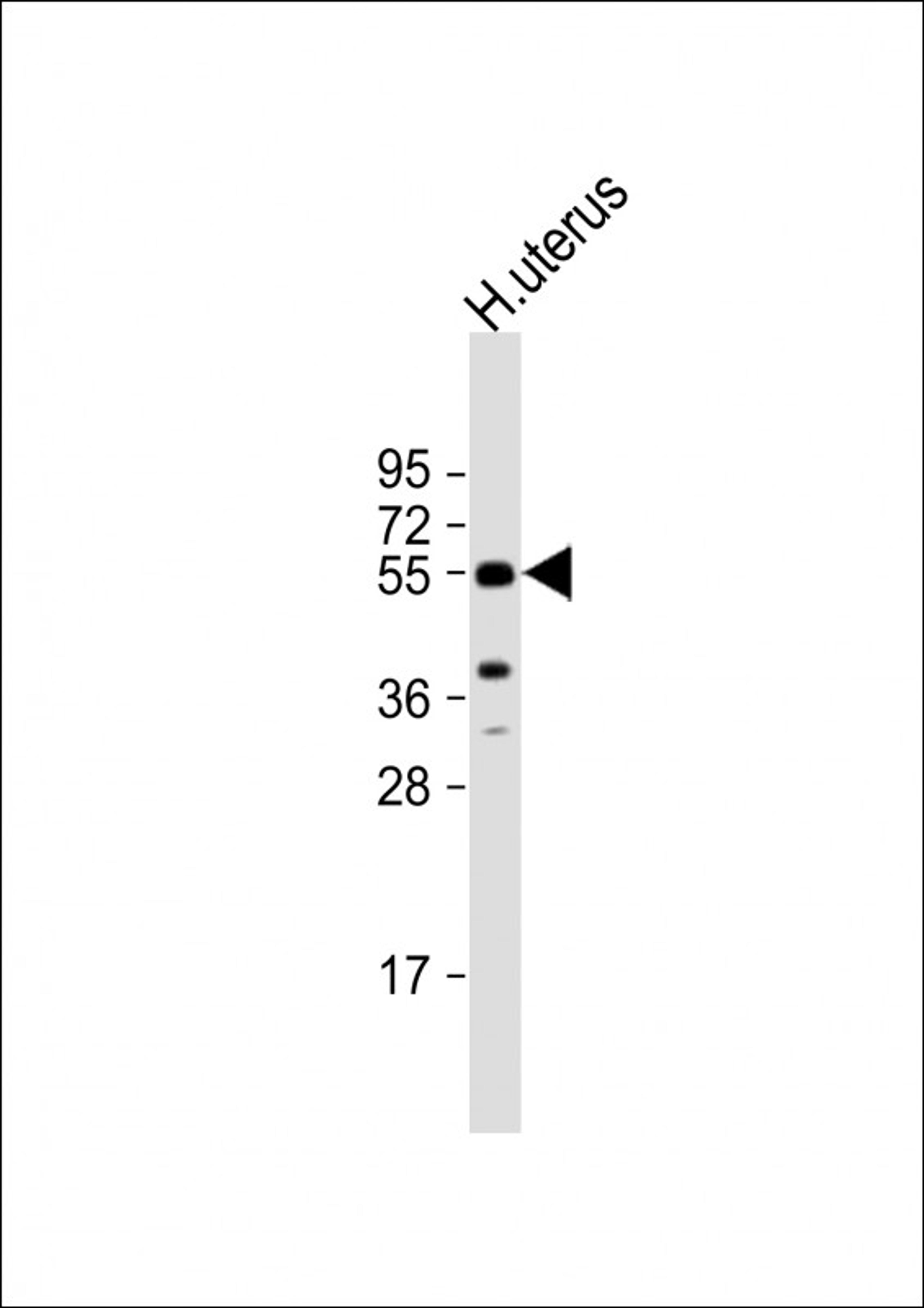 Western Blot at 1:1000 dilution + human uterus lysate Lysates/proteins at 20 ug per lane.