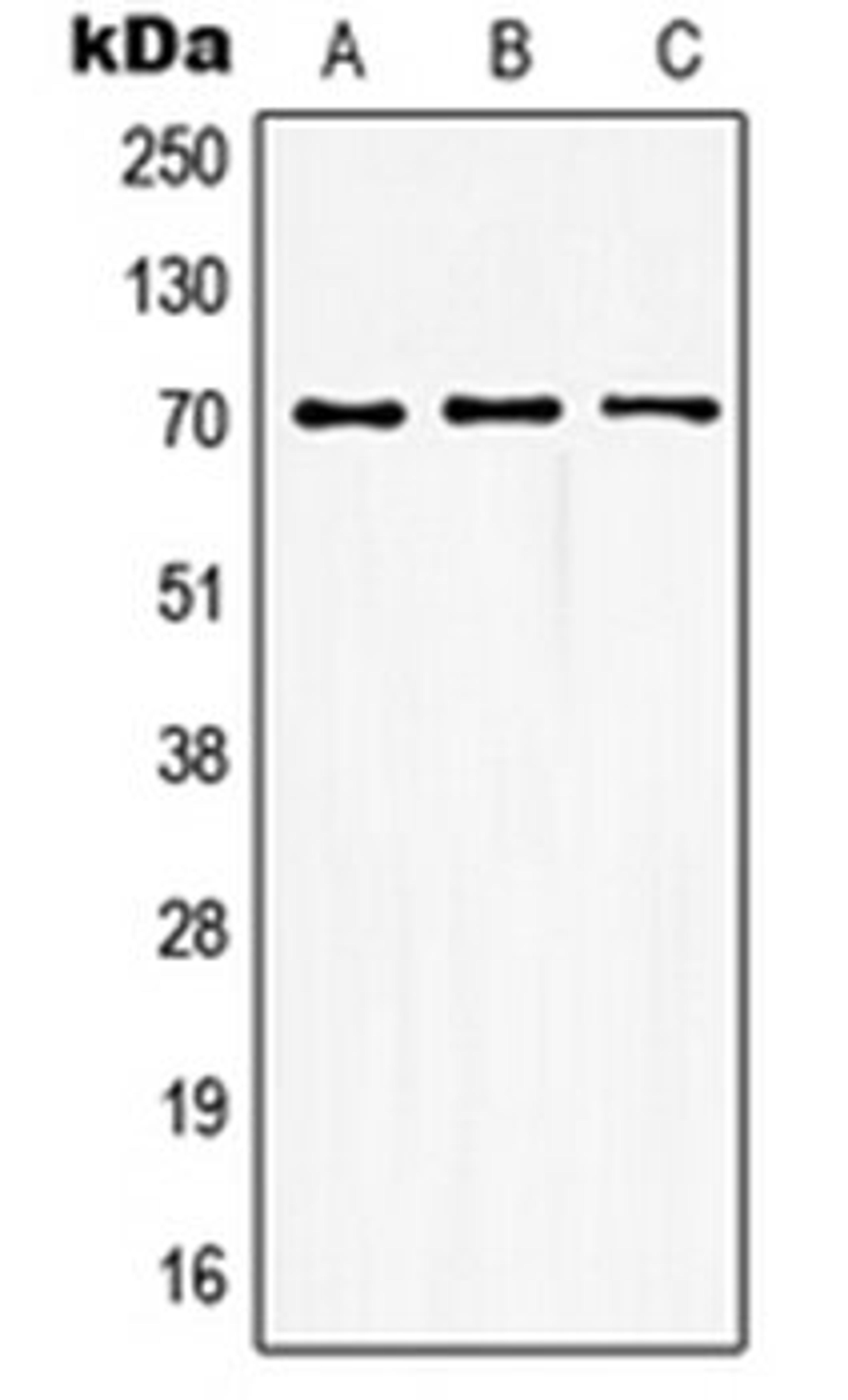 Western blot analysis of HEK293T (Lane 1), mouse kidney (Lane 2), rat kidney (Lane 3) whole cell lysates using GUCY1B3 antibody