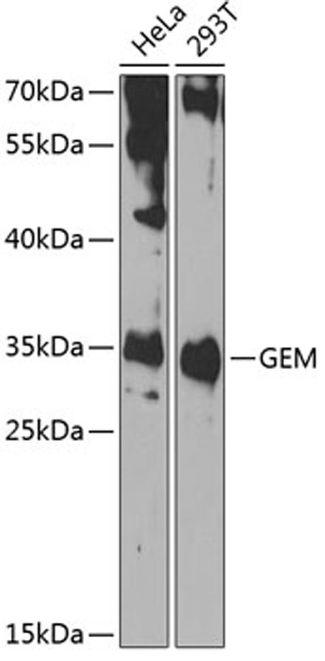 Western blot - GEM antibody (A7433)