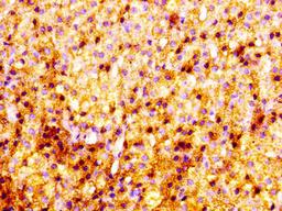 IHC image of CSB-PA02939A0Rb diluted at 1:100 and staining in paraffin-embedded human adrenal gland tissue performed on a Leica BondTM system. After dewaxing and hydration, antigen retrieval was mediated by high pressure in a citrate buffer (pH 6.0). Section was blocked with 10% normal goat serum 30min at RT. Then primary antibody (1% BSA) was incubated at 4°C overnight. The primary is detected by a biotinylated secondary antibody and visualized using an HRP conjugated SP system.