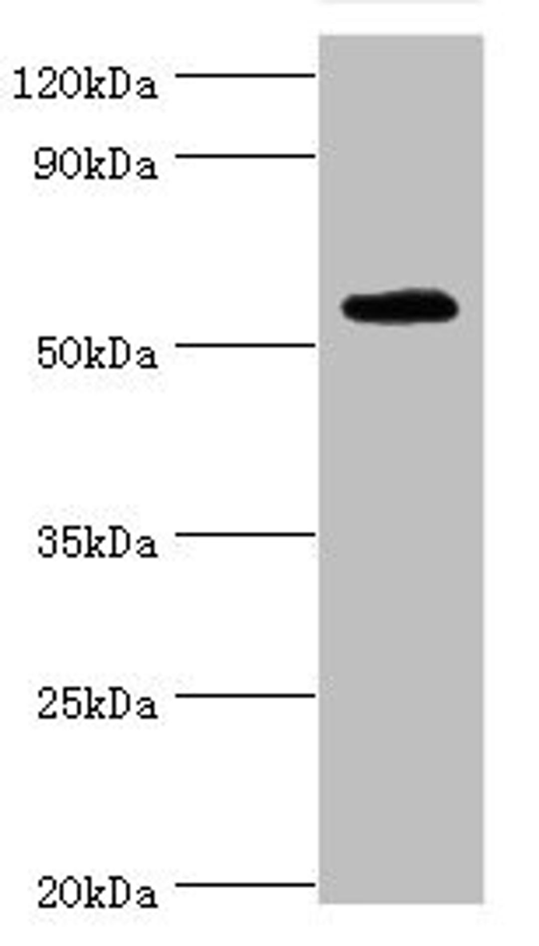 Western blot. All lanes: TSEN2 antibody at 5ug/ml + 293T whole cell lysate. Secondary. Goat polyclonal to rabbit IgG at 1/10000 dilution. Predicted band size: 54, 52, 50, 48, 46 kDa. Observed band size: 54 kDa.