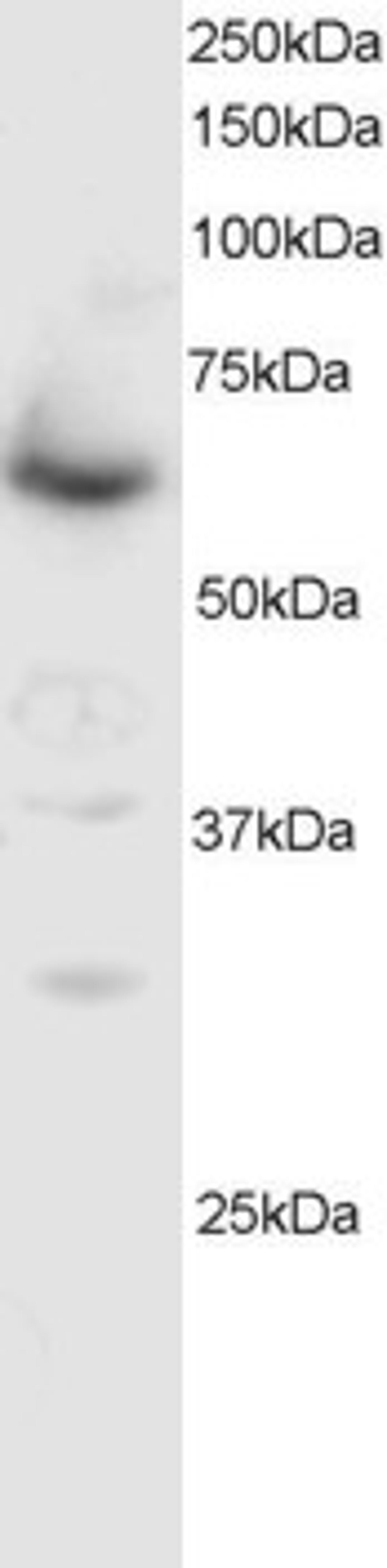Western Blot staining (0.5μg/ml) of NIH-3T3 cell lysate (RIPA buffer, 35μg total protein per lane). Primary incubated for 1 hour. Detected by western blot using chemiluminescence.
