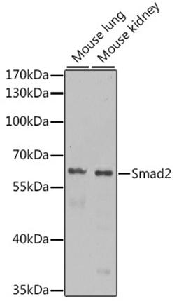 Western blot - Smad2 antibody (A11498)