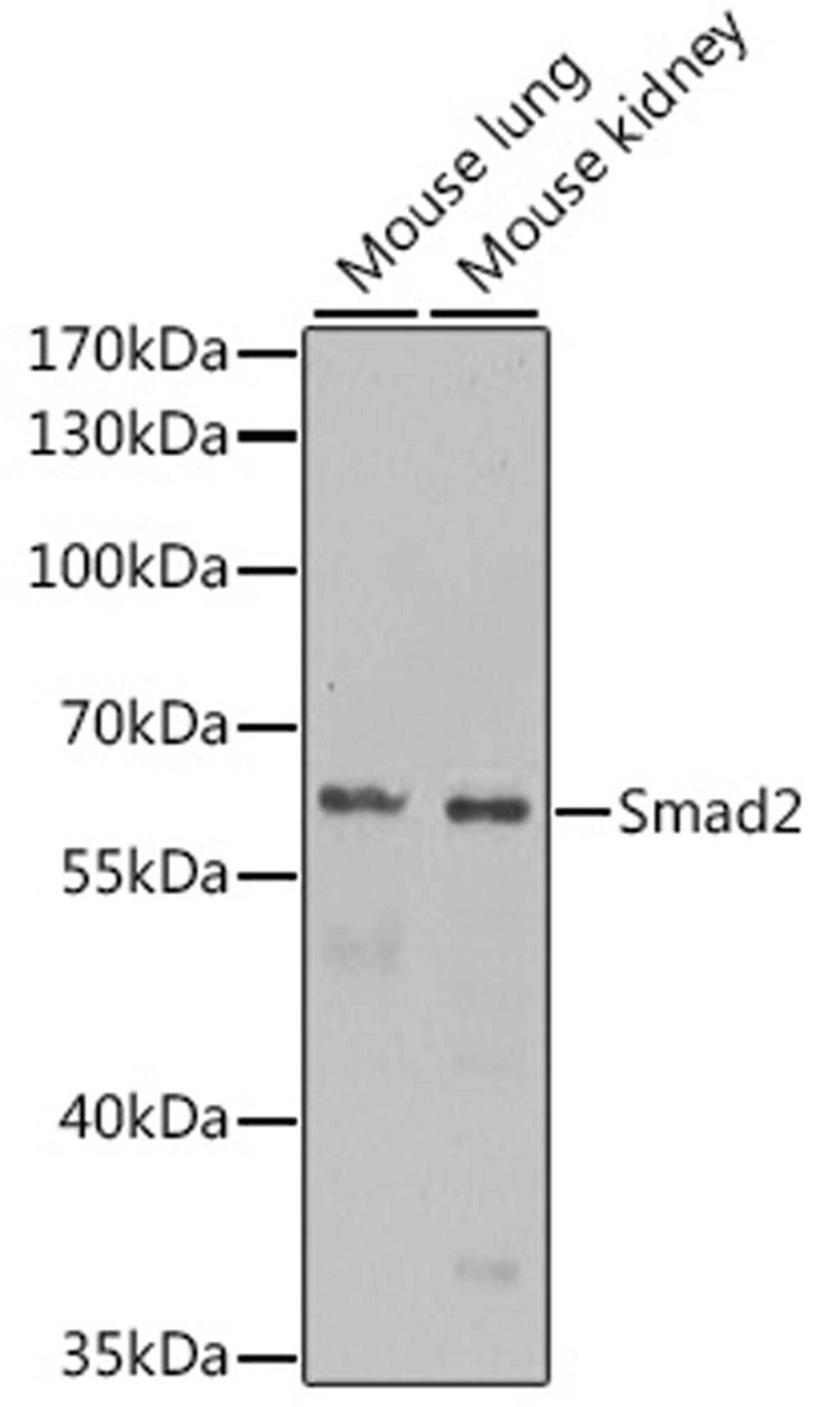 Western blot - Smad2 antibody (A11498)