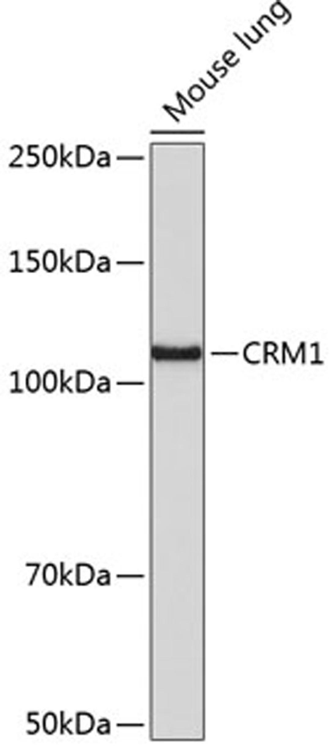 Western blot - CRM1 antibody (A19625)