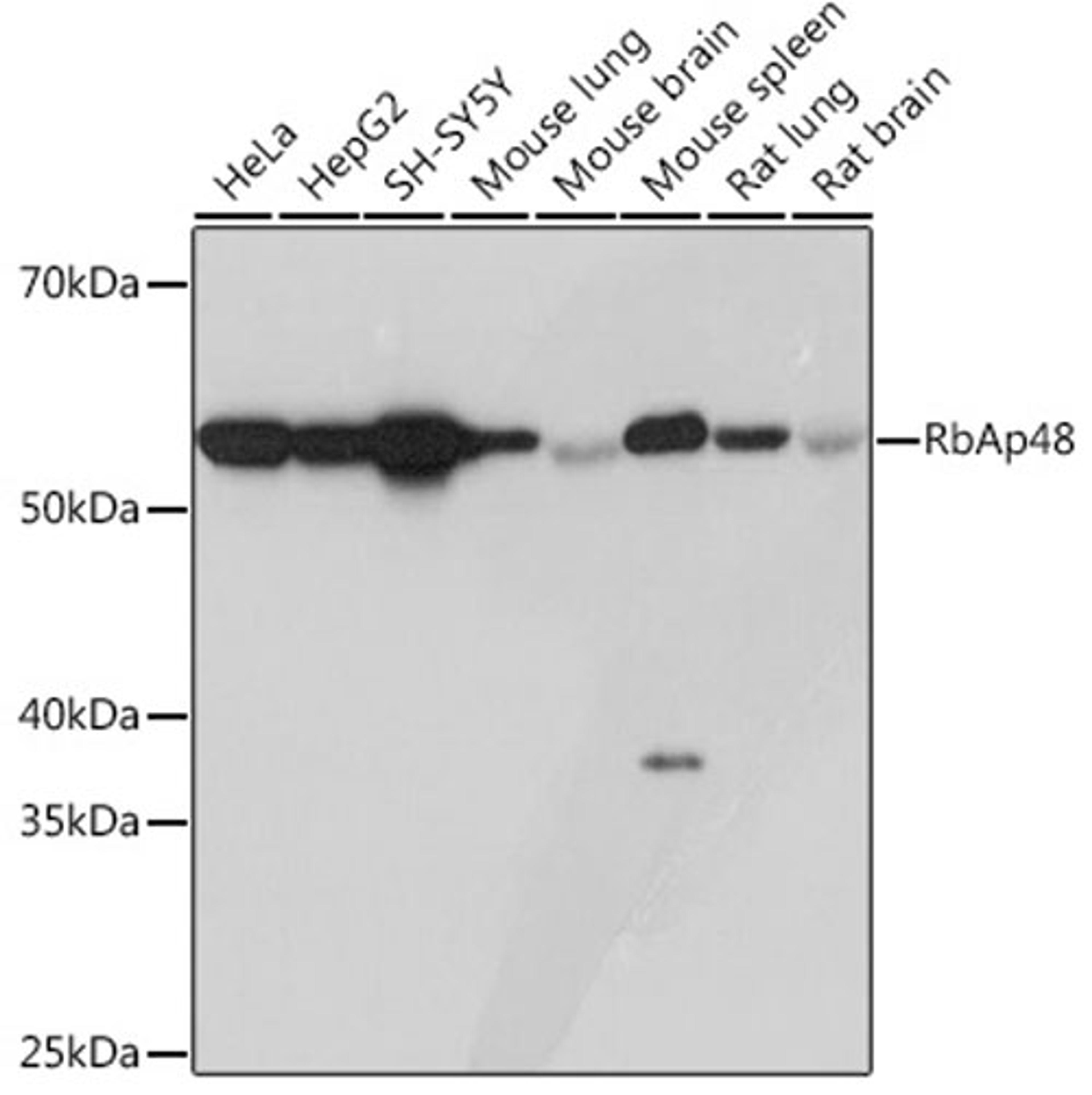Western blot - RbAp48 Rabbit mAb (A3645)