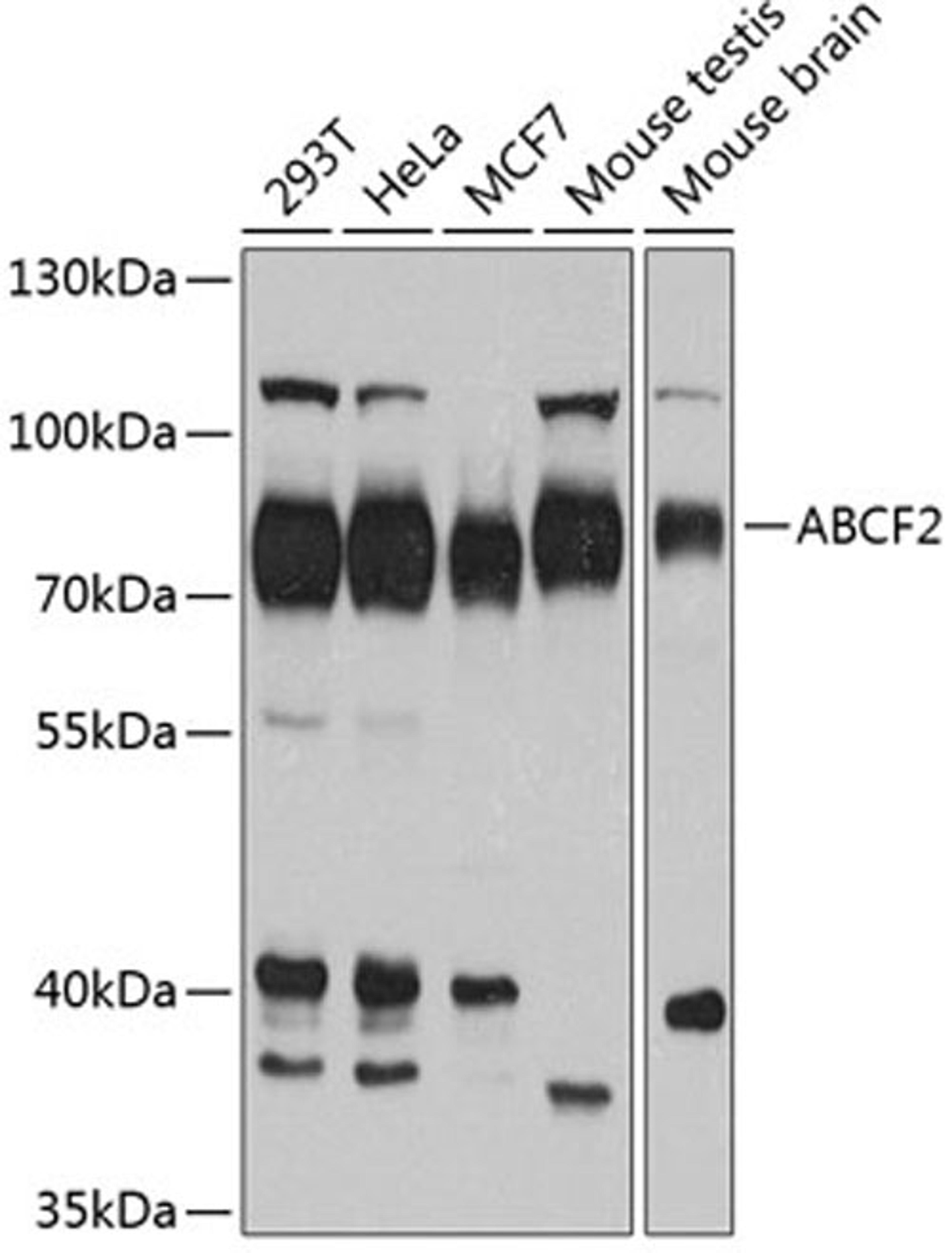 Western blot - ABCF2 antibody (A4365)