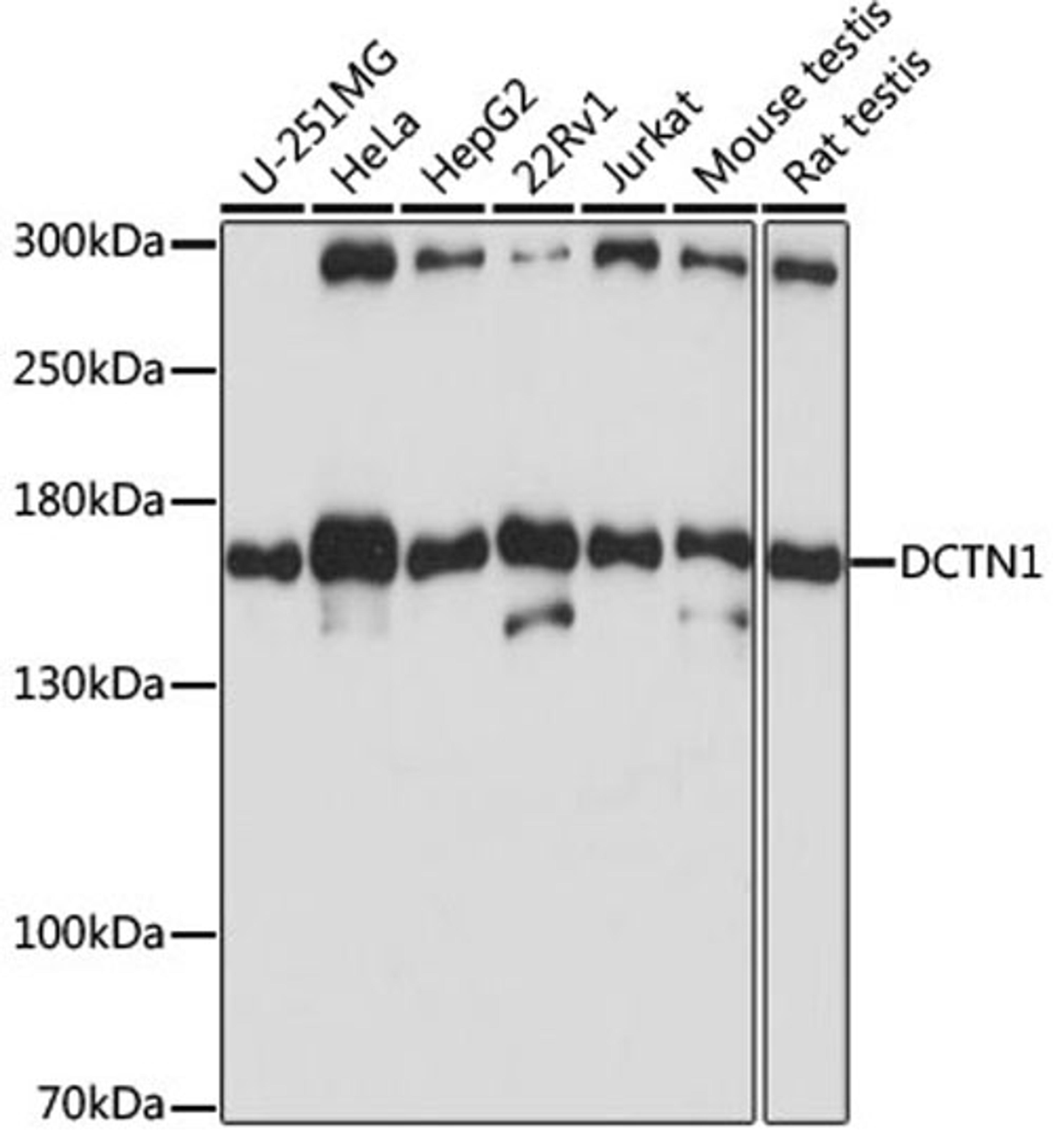 Western blot - DCTN1 antibody (A1783)