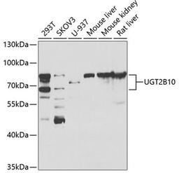 Western blot - UGT2B10 antibody (A7570)