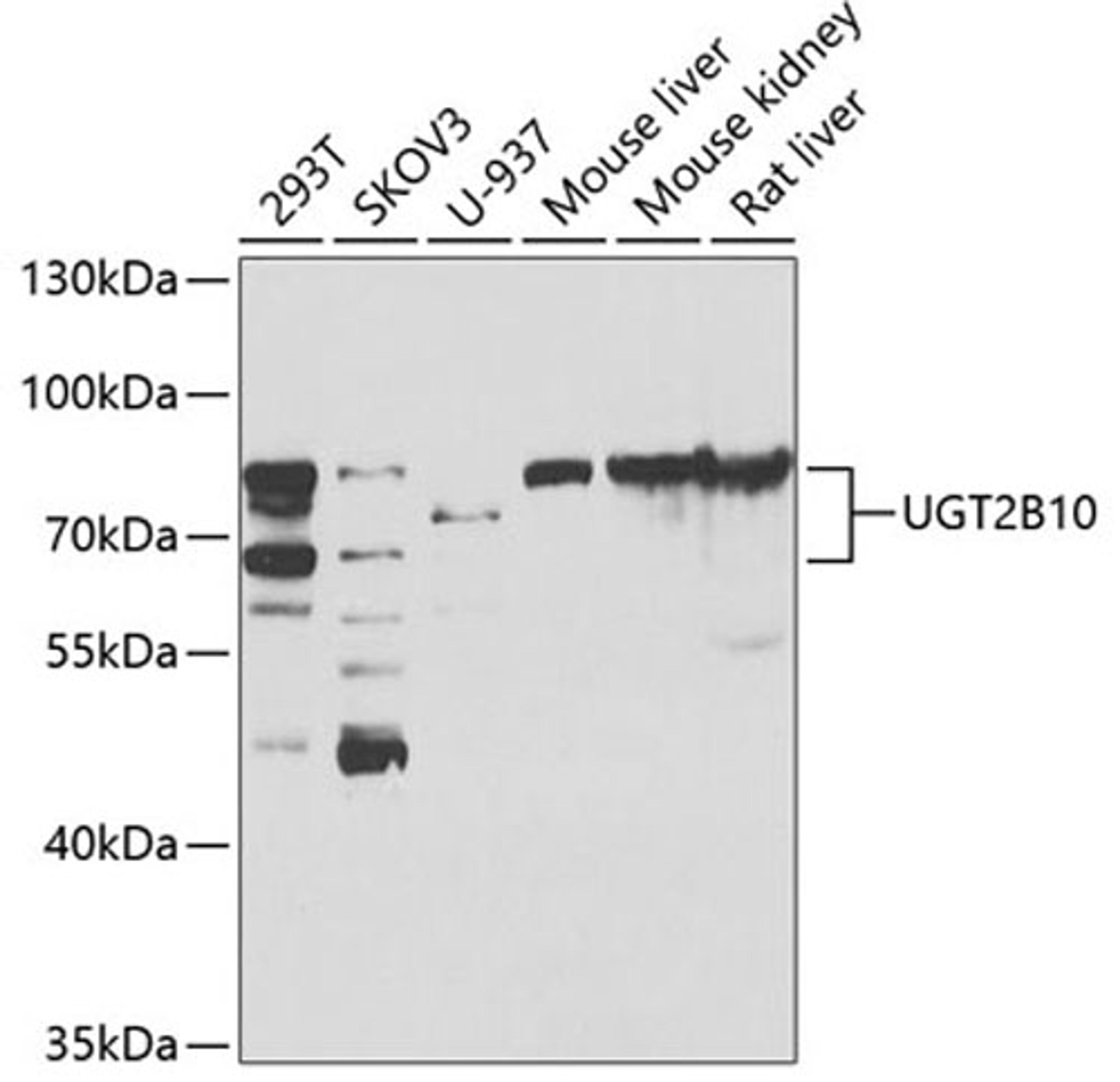 Western blot - UGT2B10 antibody (A7570)