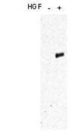 Western blot analysis of Human mammary B5/589 epithelial cells using Y1356 antibody