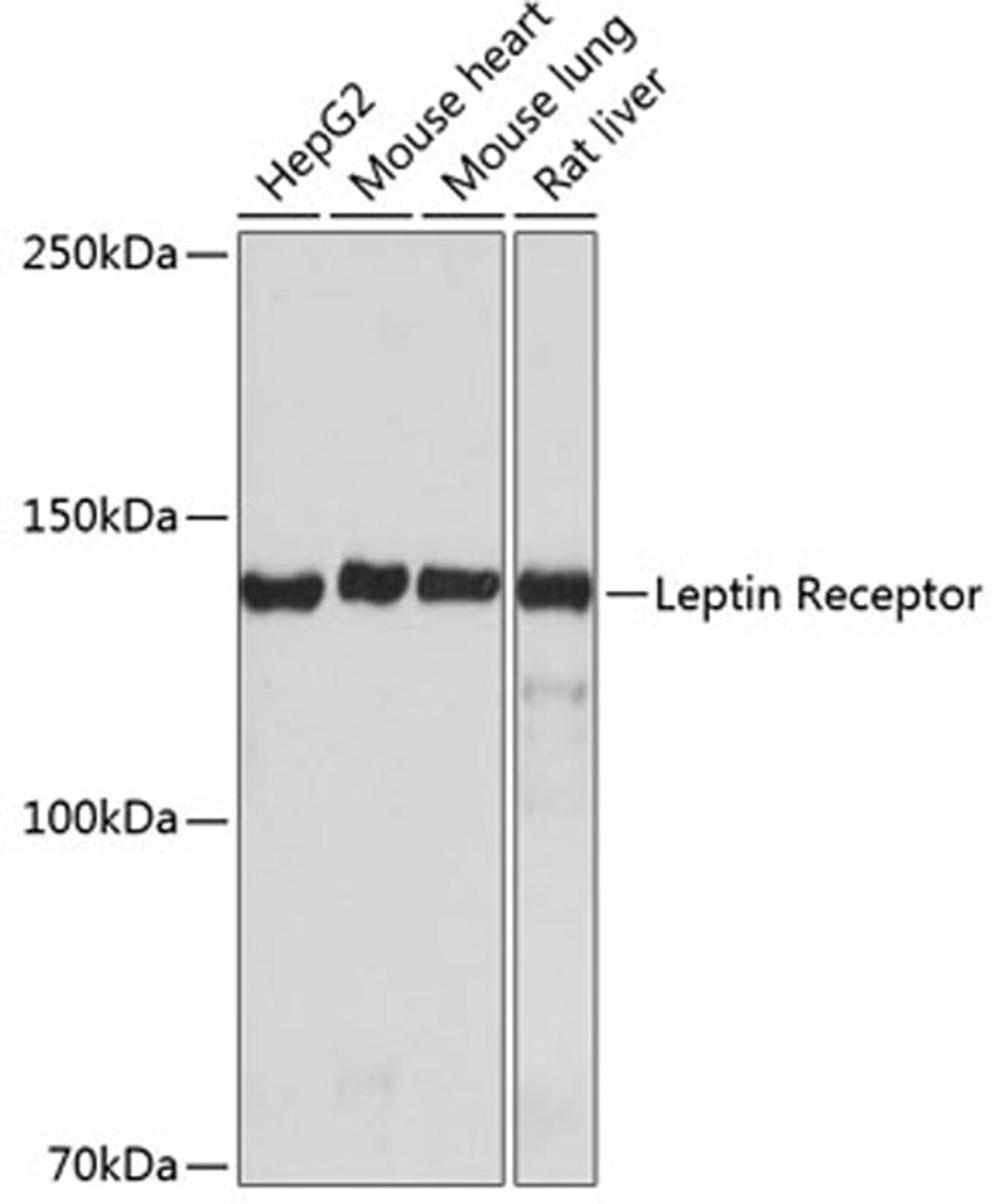 Western blot - Leptin Receptor antibody (A19076)