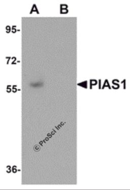 Western blot analysis of PIAS1 in human kidney tissue lysate with PIAS1 antibody at 1 μg/mL in (A) the absence and (B) the presence of blocking peptide.