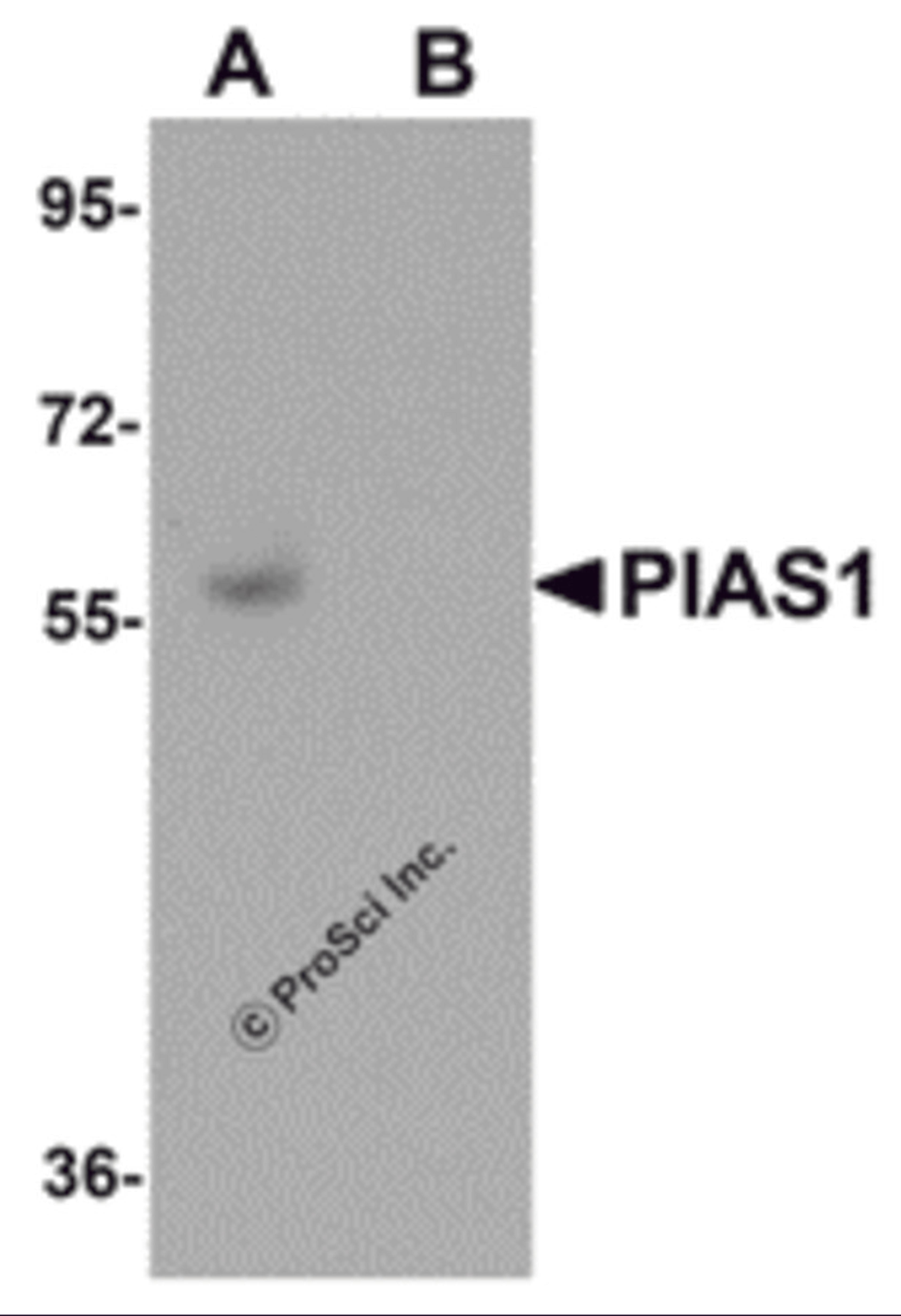 Western blot analysis of PIAS1 in human kidney tissue lysate with PIAS1 antibody at 1 μg/mL in (A) the absence and (B) the presence of blocking peptide.